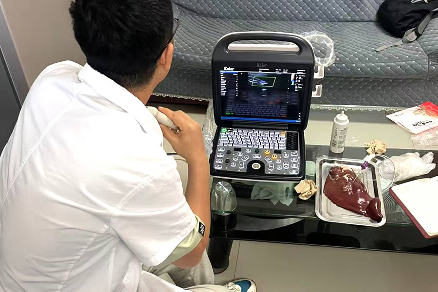 四維彩超檢查什么?有什么好處?多少錢?